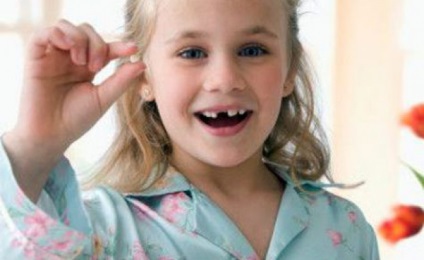 Leziuni ale dinților la copii și tratament, vitaportal - sănătate și medicină