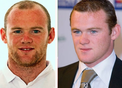 Wayne Rooney neagă transplantul de păr, jucătorul a spus cum a scăpat, de fapt, de locul său chel