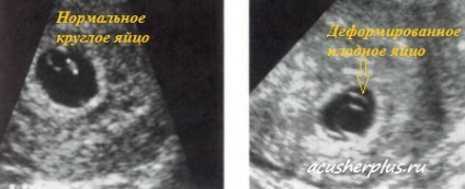 Uzi la 5-6 săptămâni de sarcină - cum să găsești copilul în imagine
