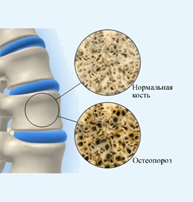 Echipament angiografic - siemens artis zee