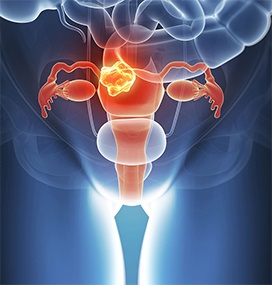 Echipament angiografic - siemens artis zee