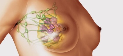 Ceea ce este glanda mamară mamară - semnează modul de tratare