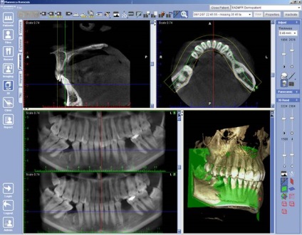 Scanner digital promax 3d clasic, planmeca, finland - vanzari si service