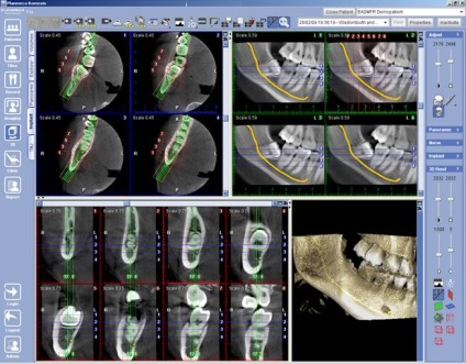 Scanner digital promax 3d clasic, planmeca, finland - vanzari si service