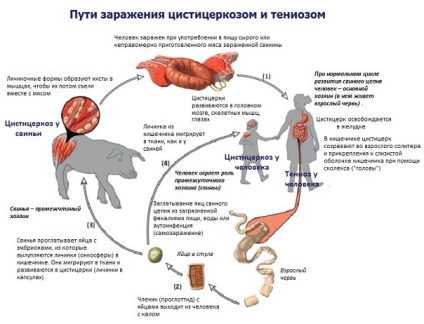 Tipurile de infecție cu cistercerculoză cu căi de transmisie și modalități de tratament