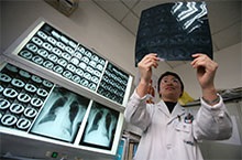 Endocrinologie în tratamentul hipotiroidismului în China