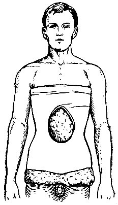 Tencuielile din 1976 - cartea de referință a surorilor de operare și dressing