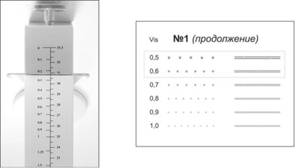 Tratamentul și corectarea miopiei de miopie (miopie)