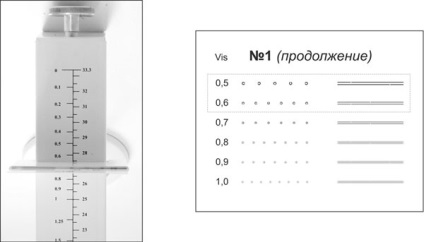 Tratamentul și corectarea miopiei de miopie (miopie)