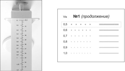 Tratamentul și corectarea miopiei de miopie (miopie)