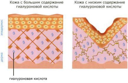 Cât de repede se dizolvă acidul hialuronic