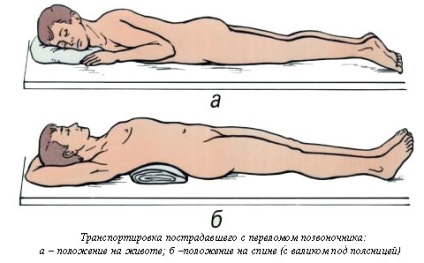Fractura de compresie a coloanei vertebrale la un copil - profesorul îl va ajuta pe Vissarionov
