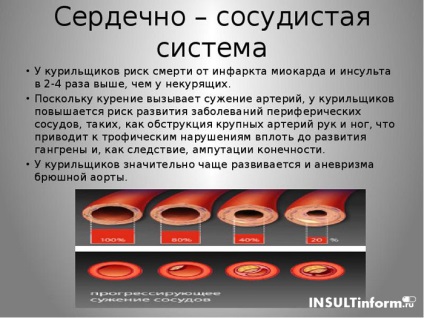 Dohányzás és stroke után is füstölhetek, miután a dohányzás hatással van az agy hajaira