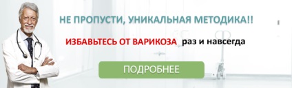 Tratamentul varicelor în Ufa cele mai bune prețuri în oraș, tratamentul varicelor