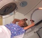 Radioterapia în cancer, răspunsurile medicilor, consultare