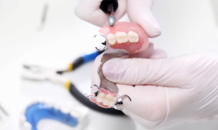 Materiale pentru protezele dentare