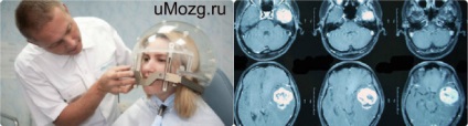 Meningiomul creierului după intervenție chirurgicală, prognostic