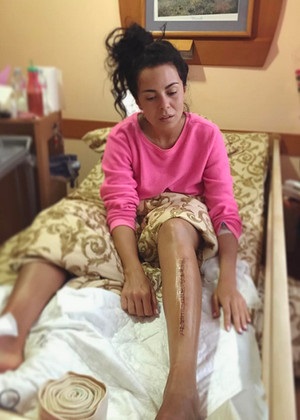 Nastia Kamensky a efectuat din nou o operație pe picioarele ei - ziua femeii