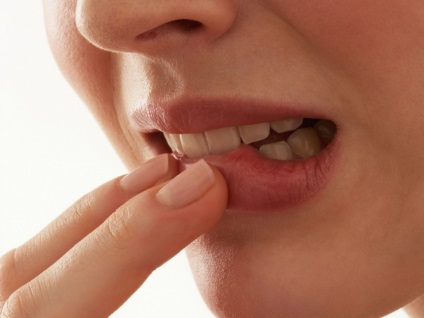 На езика и в лечението на устата брадавици е да се премахнат причините за
