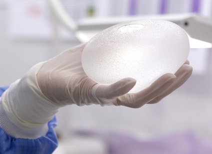 Revizuirea implanturilor mamare (implanturi mamare), pe care implanturile mamare sunt mai bune, revista online