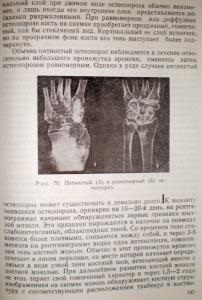 Determinarea prescripției fracturii coastelor prin metode cu raze X - medicina medico-legale din fr