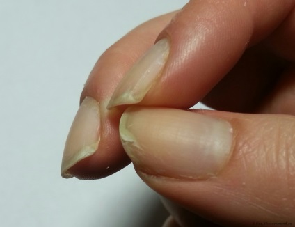 De ce unghiile sunt exfoliate