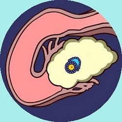 Dimensiunea corpului galben după ovulație este de 1, 2