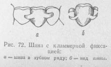 Shinizarea dinților de mestecat, stomatologia ortopedică