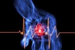 Simptomele stenocardiei