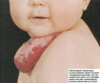 Semnele vasculare la copii (cunoștințe - pediatrie)