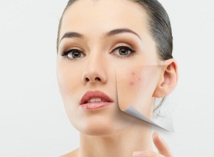 Eliminarea petelor pigmentate cum să îmbunătățească rapid și eficient starea pielii