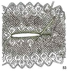 Vârsta de tricotat este un secol, învață! Cum să tricot medalioane cu ace de tricotat, jurnal de irimide