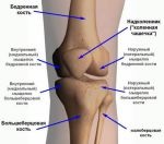 Dislocarea articulației genunchiului - simptome, tratament și reabilitare