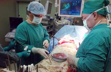 Doctorii din Yakut au efectuat mult timp transplanturi de organe