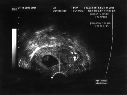 3 săptămâni de sarcină de la conceperea senzației, dezvoltarea fătului, nutriție