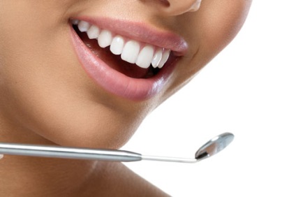 5 Proceduri pentru frumusețea dinților