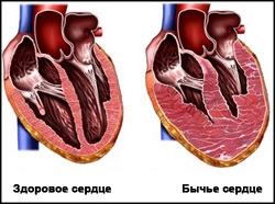 артеріальний кровотеча