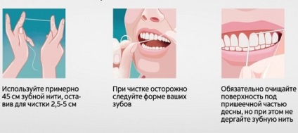 Gingiile s-au îndepărtat de dinte - ce să facă dacă dintele de pe gingie este gol - portal dentar