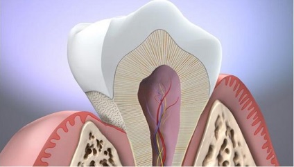 Gingiile s-au îndepărtat de dinte - ce să facă dacă dintele de pe gingie este gol - portal dentar