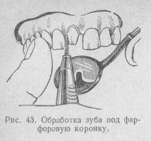 Coroane de porțelan, stomatologie ortopedică