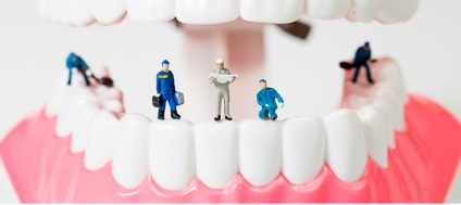 Implantarea prețului dinților în fotografie perm, beneficii și contraindicații