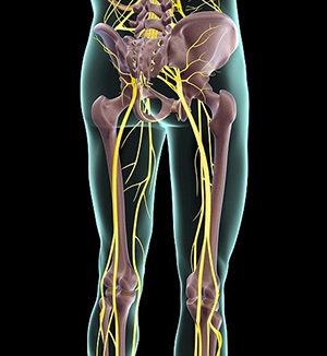 Sciatica simptome și tratament la domiciliu