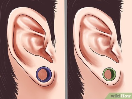 Cum să scapi rapid și ușor de o ruptură în lobul urechii