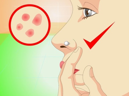 Cum de a trata o infecție a piercingului în nas - vripmaster