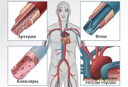 Hogyan erősítsük meg az edényeket - egészséges hosszú élettartam