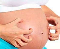 A bőrviszketés a terhesség idején és a pruritus terhességi kezelésére terhes nőknél korai és késői időszakokban