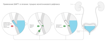 Vegyél 100% szintetikus droggátot 3000 rúdhoz