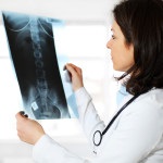 Tratamentul osteoporozei la femei - specificitatea procesului, metode de prevenire