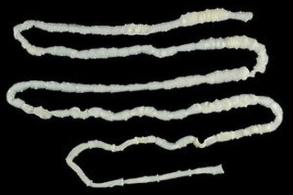 segmente de vierme de bandă condilom cum se elimină