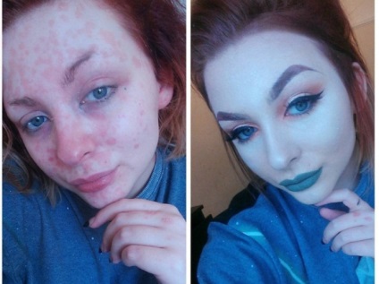 Machiajul - o salvare de la boala psoriazisului a determinat-o pe fata să stăpânească profesia de make-up artist